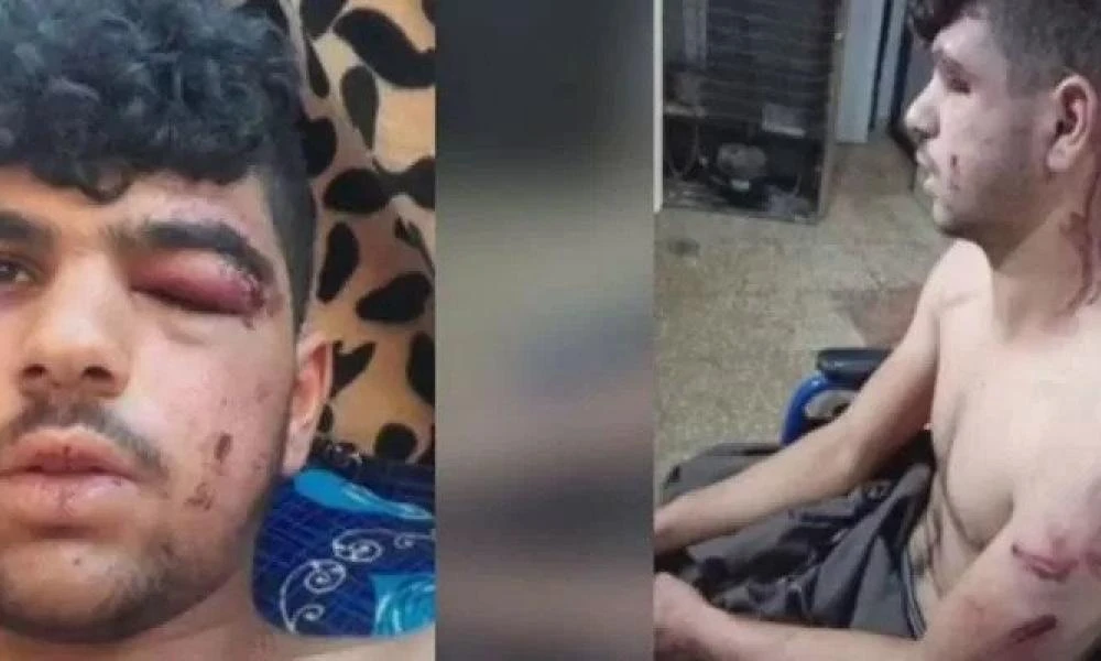 Τουρκία: "Μας ρώτησαν αν είμαστε Κούρδοι και μετά μας άρπαξαν στο ξύλο"
